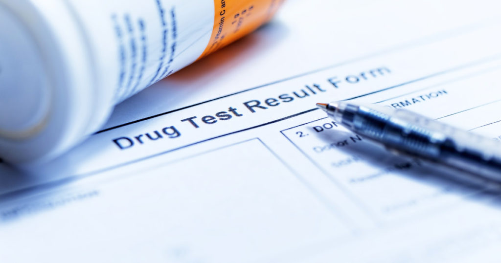 will cbd show up in a drug test